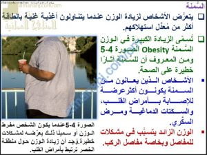 ملخص شرح درس السمنة وسوء التغذية مع حل الأنشطة (أحياء) التاسع