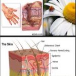 تحميل كتاب الحروق PDF تأليف د. ألفت الشافعي مجانا [كامل]