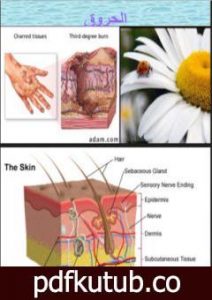 تحميل كتاب الحروق PDF تأليف د. ألفت الشافعي مجانا [كامل]