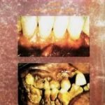 تحميل كتاب صحة الفم والأسنان PDF تأليف عبد الله عبد الرزاق مسعود السعيد مجانا [كامل]