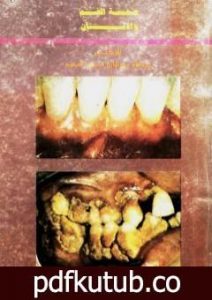 تحميل كتاب صحة الفم والأسنان PDF تأليف عبد الله عبد الرزاق مسعود السعيد مجانا [كامل]
